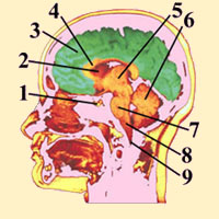 MRI BRAIN SCAN