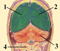 REAR CROSS SECTION OF SPLIT  BRAIN